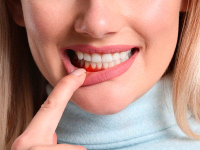 Periodontia Campinas - SP
