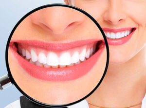 Clareamento Dental Nova Campinas