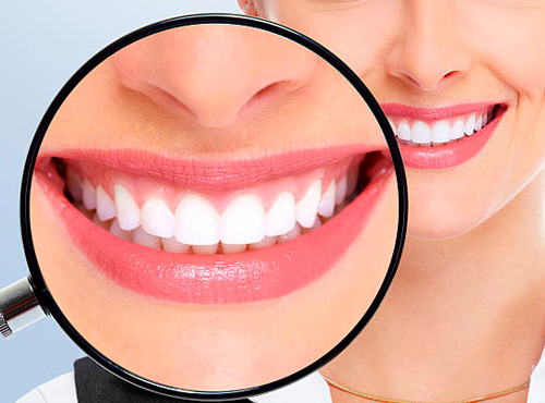 Clareamento Dental Nova Campinas