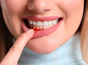 Doença periodontal