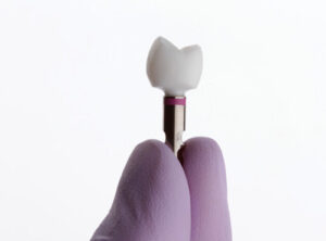 Fracture Resistance of the Implant