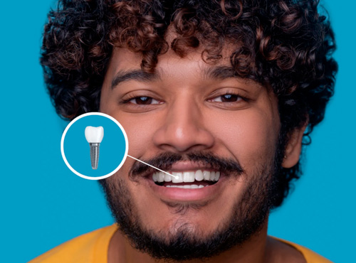 Implante de Prótese Dentária Campinas