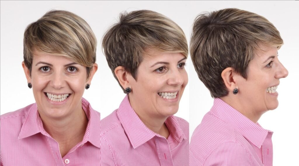 Posso Aprovar Meu Novo Sorriso Antes do Tratamento (1)